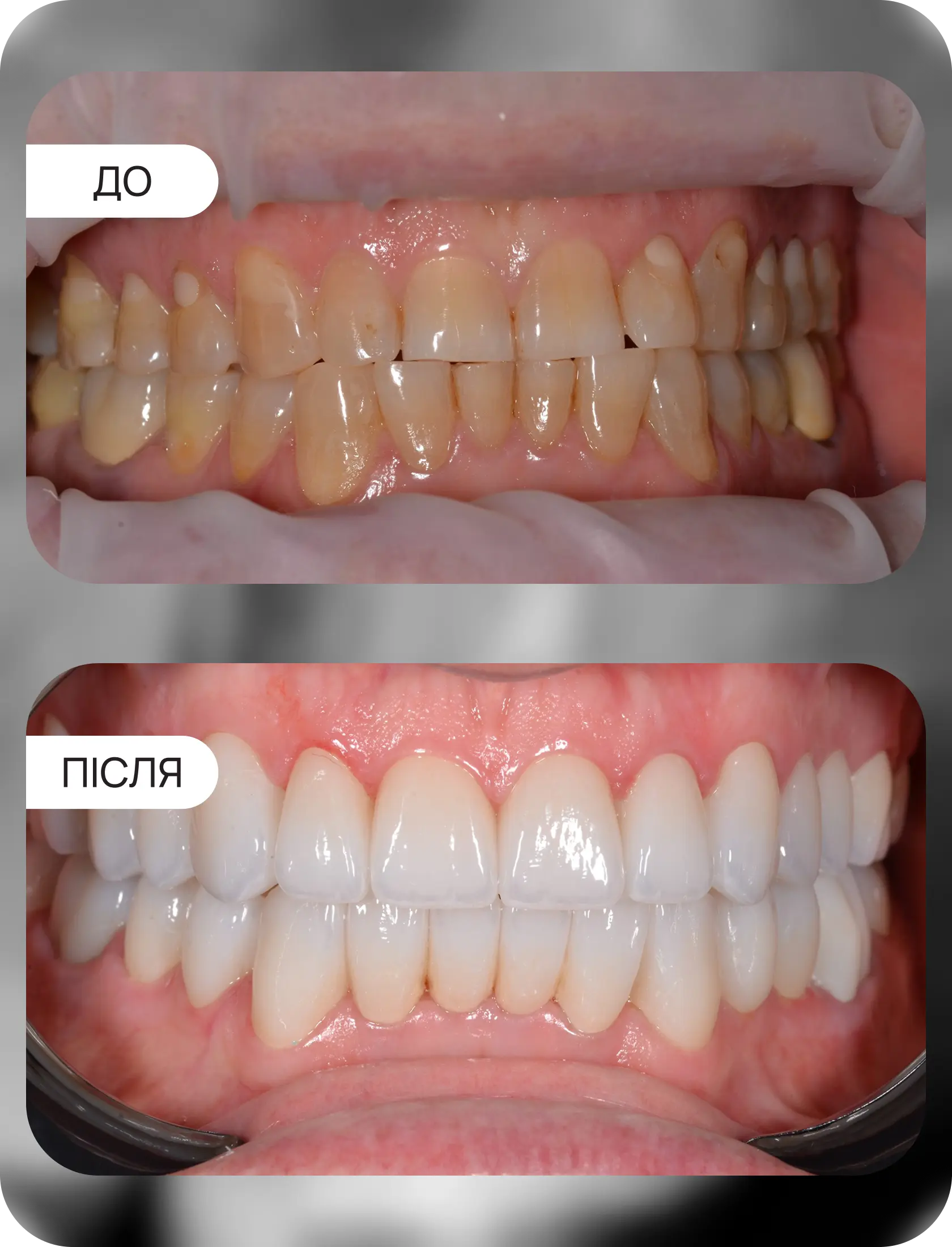 Тотальная работа вініри