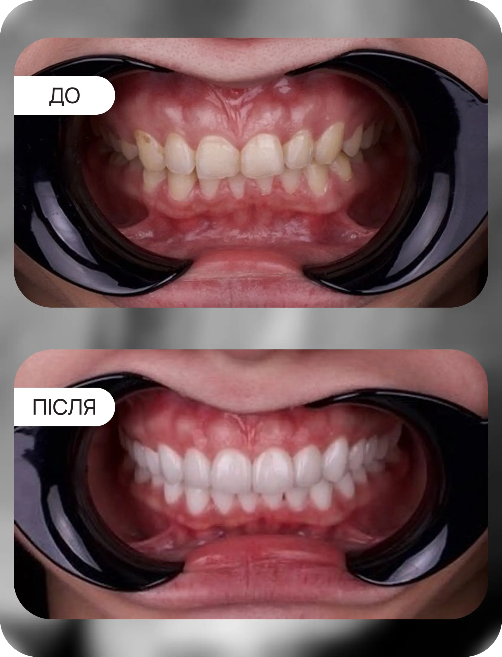 Тотальная работа вініри