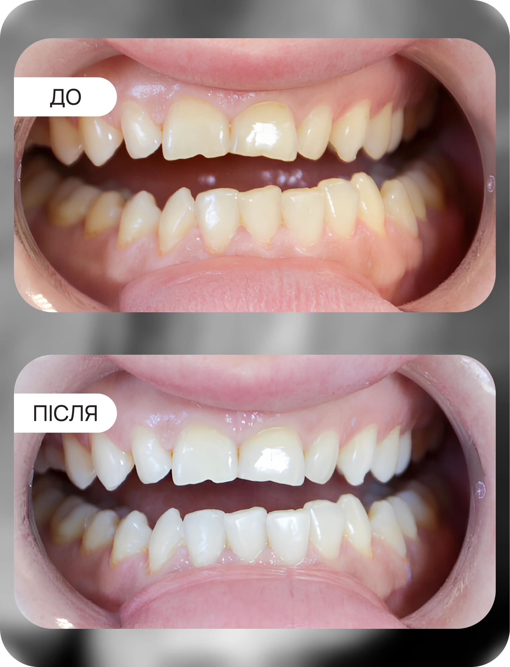 ВІДБІЛЮВАННЯ