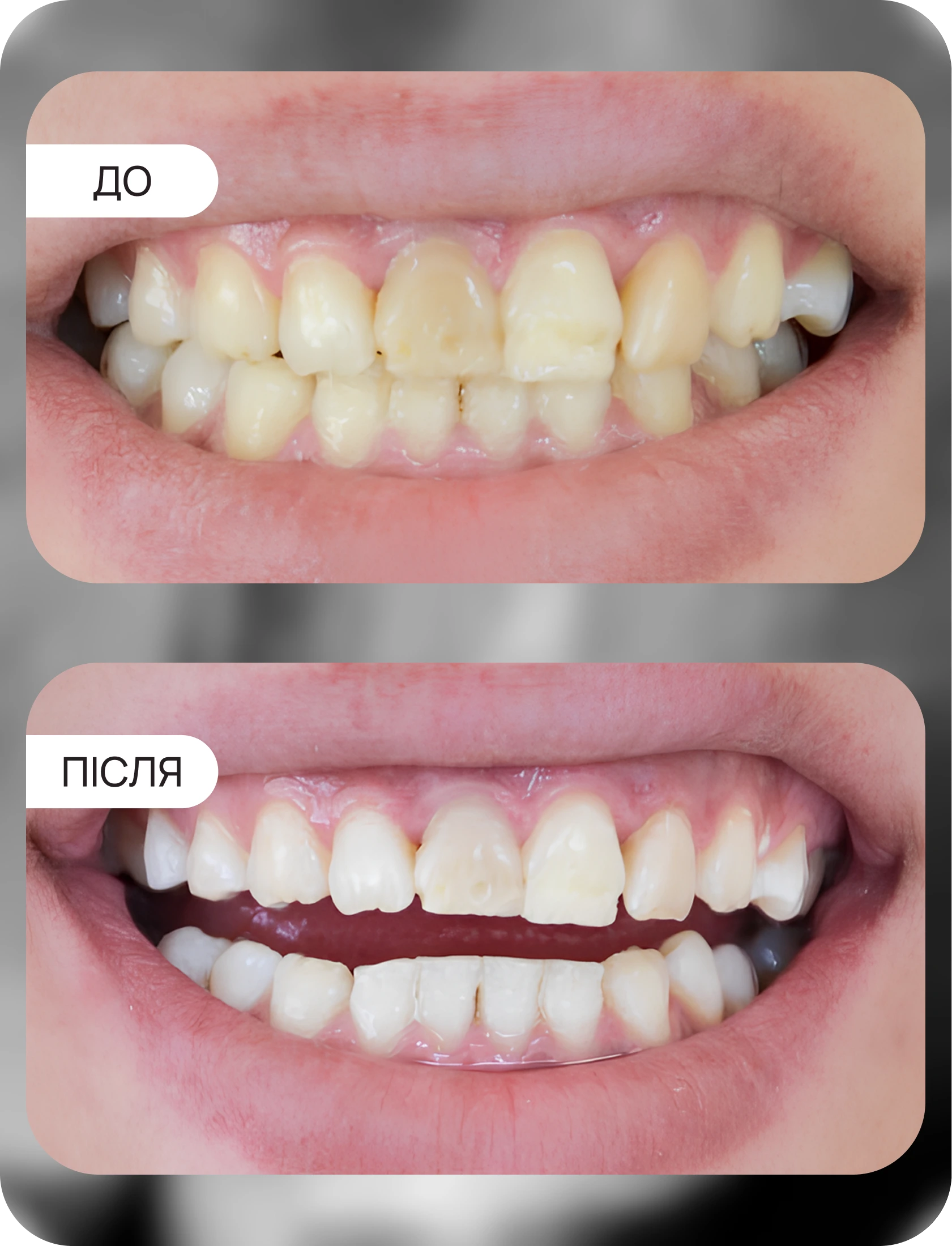 ВІДБІЛЮВАННЯ