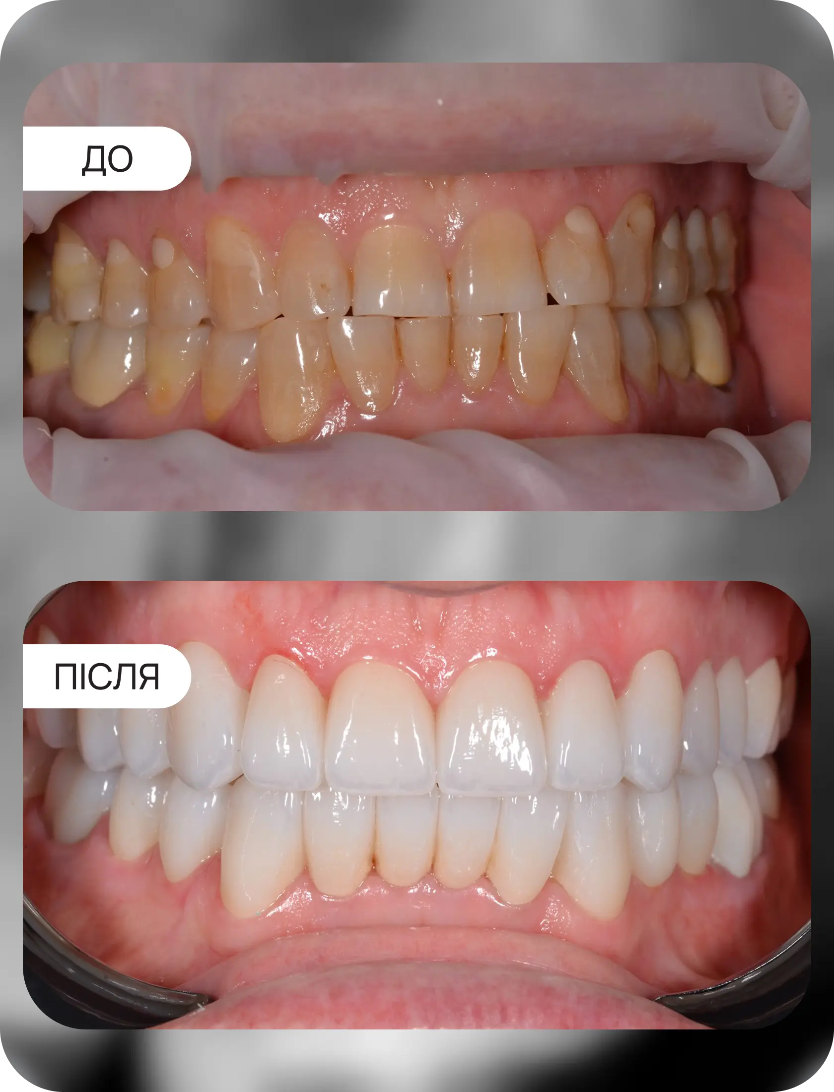 Клінічні кейси