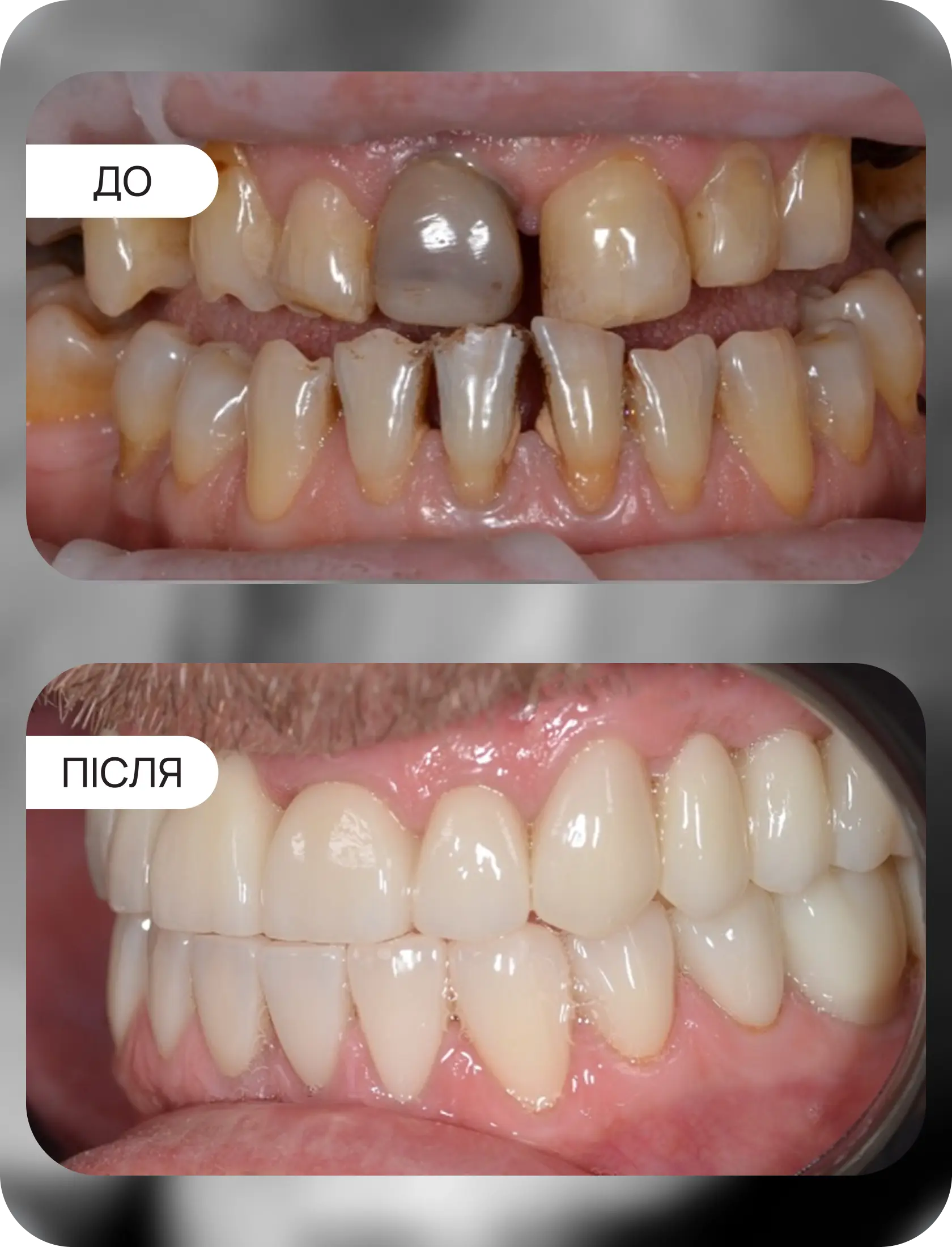 Клінічні кейси