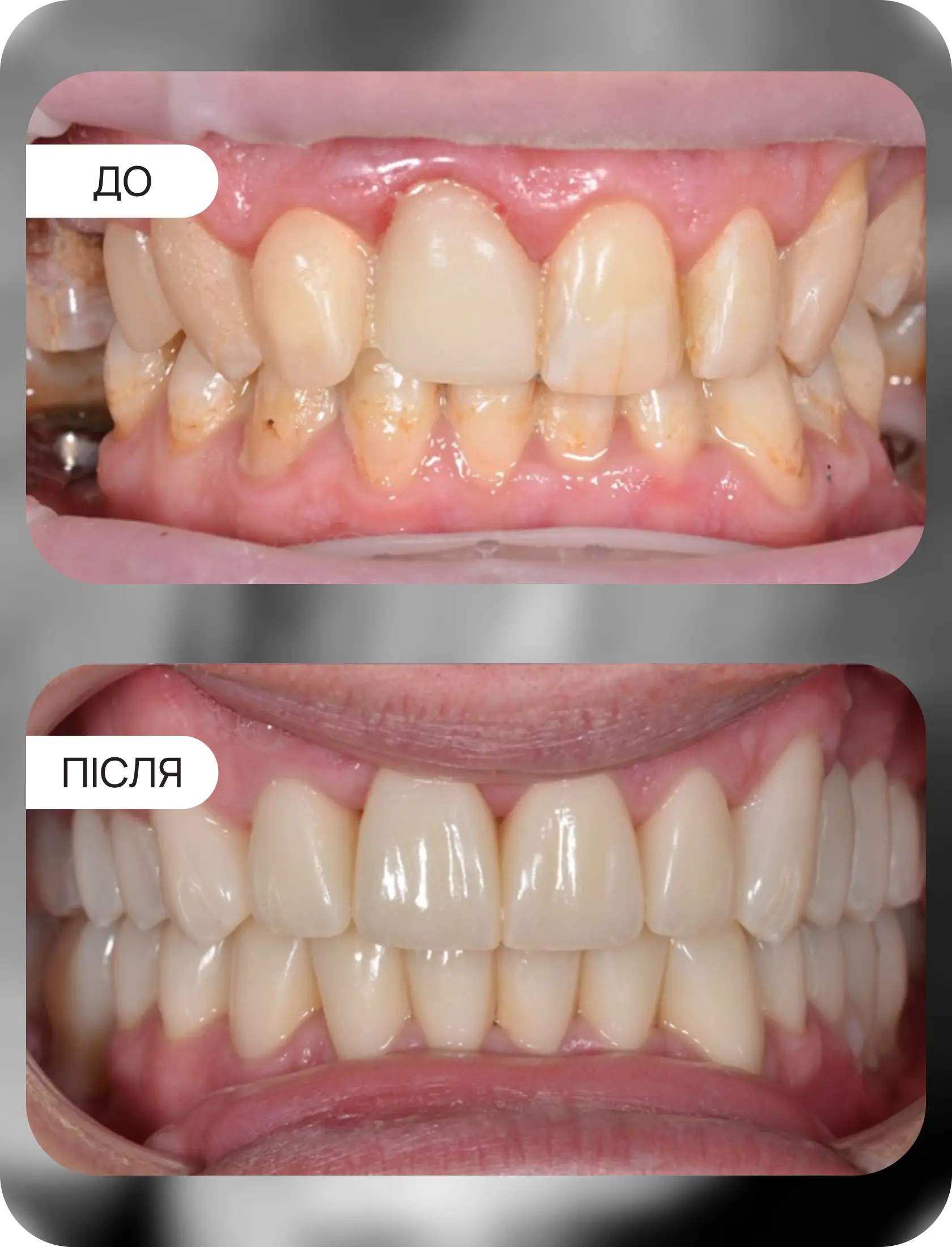 Клінічні кейси