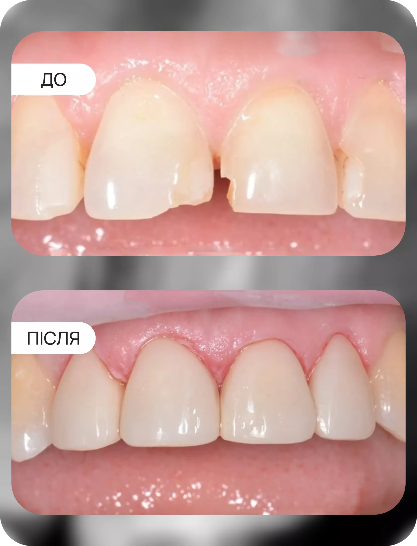 Клінічні кейси