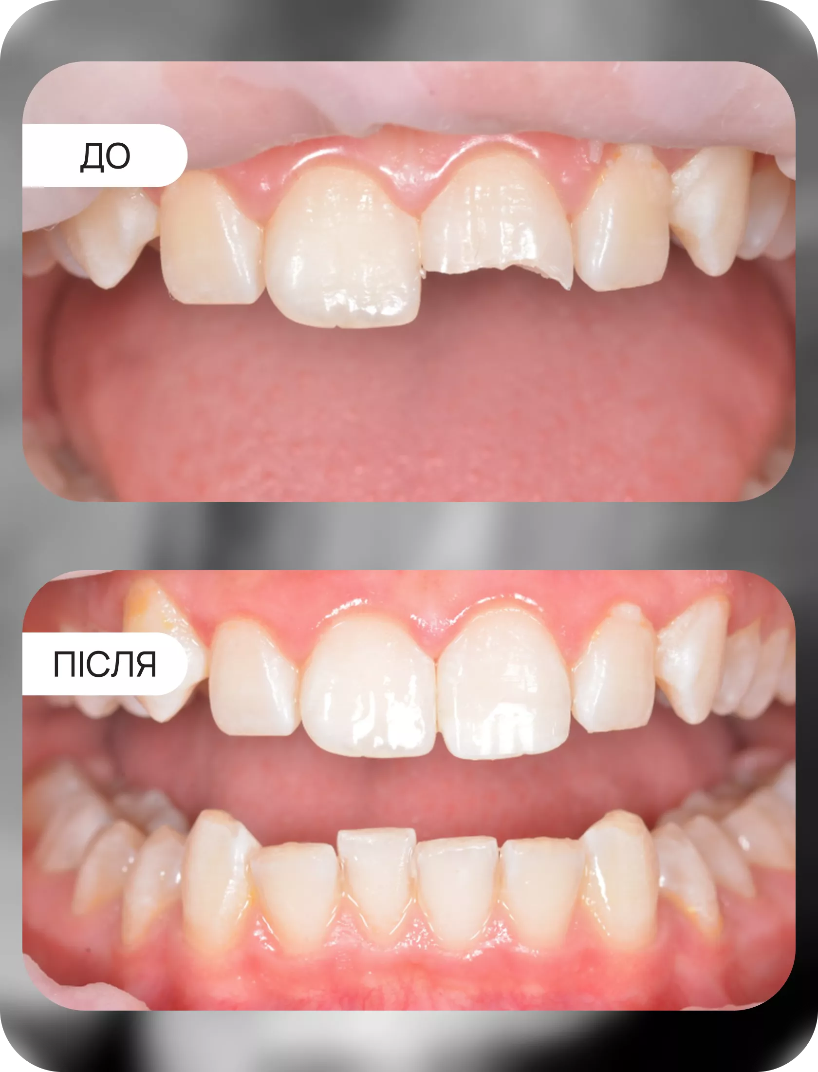 Клінічні кейси